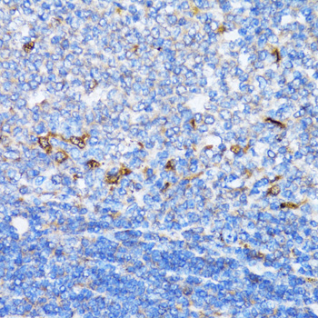NDE1 Polyclonal Antibody[30827