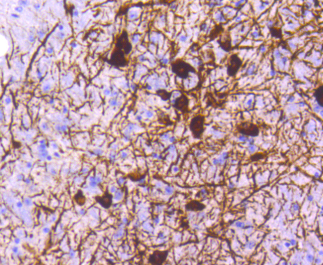 Tyrosine Hydroxylase Rabbit mA