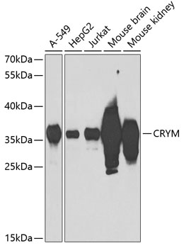 CRYM Polyclonal Antibody[30491