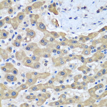 GFM1 Polyclonal Antibody[30635