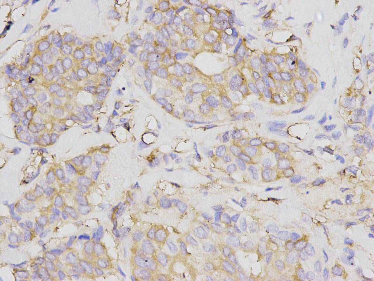 NF-κB p105/p50 Antibody[48171]