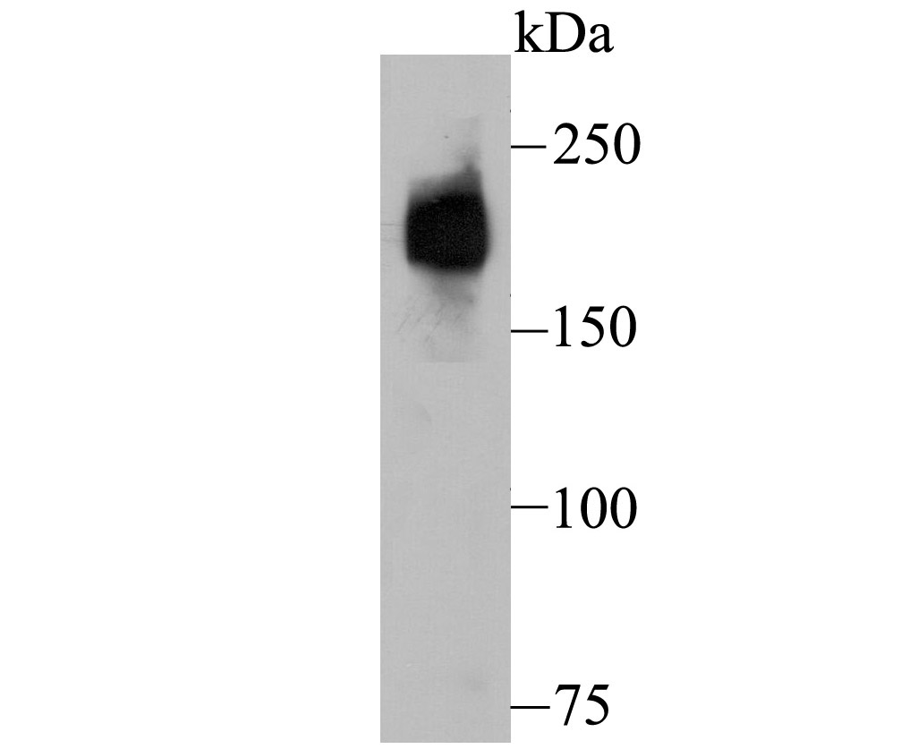 Dysferlin (DYSF) Antibody[4850
