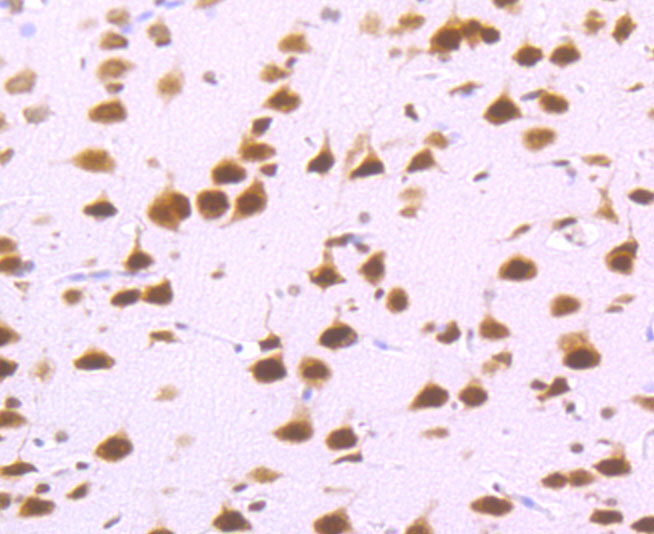 DDX5 Rabbit mAb[49625]