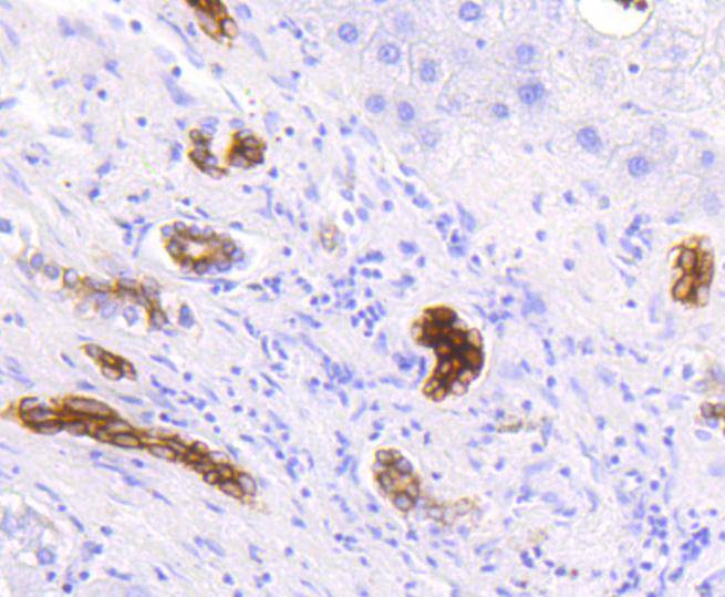 Cytokeratin 19 Rabbit mAb[4862