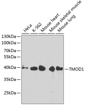TMOD1 Polyclonal Antibody[3052