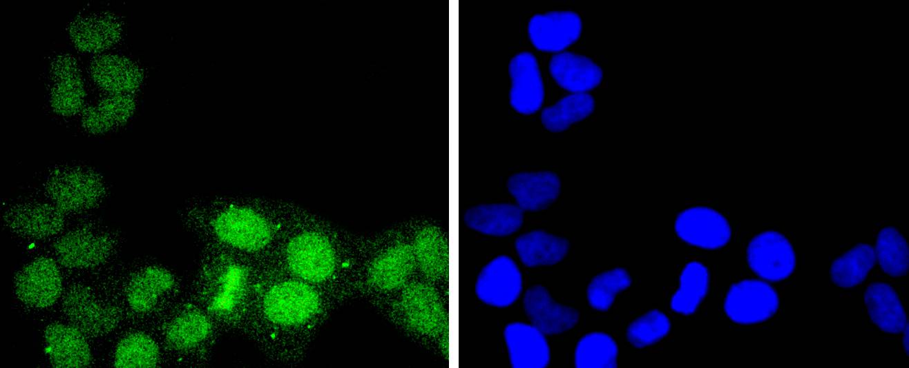 ATF1 Rabbit mAb[49239]
