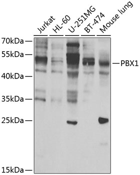 PBX1 Polyclonal Antibody[30965