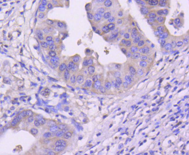 Cdk4 Rabbit mAb[49117]