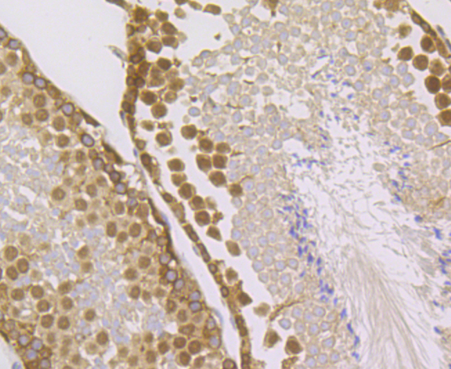 IMPDH2 Rabbit mAb[49979]