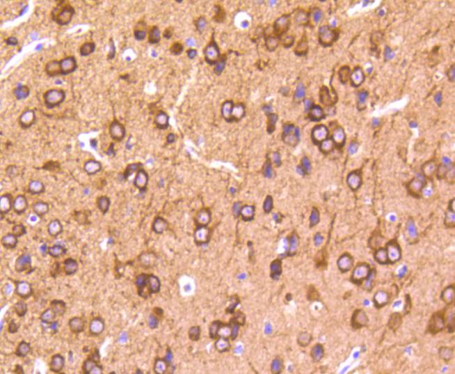Phospho-Tau(T231) Rabbit mAb[1