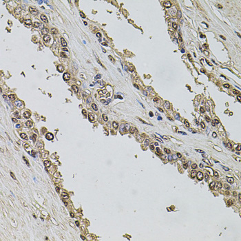 SET Polyclonal Antibody[29117]