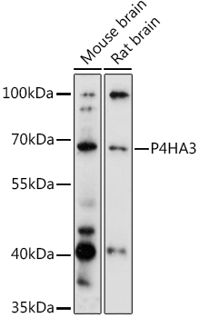 P4HA3 Polyclonal Antibody[2834