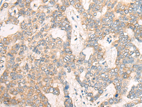 CSNK1G1 Antibody[46992]