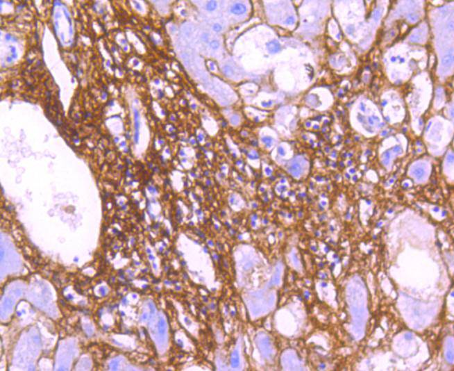 Collagen VI Rabbit mAb[49207]