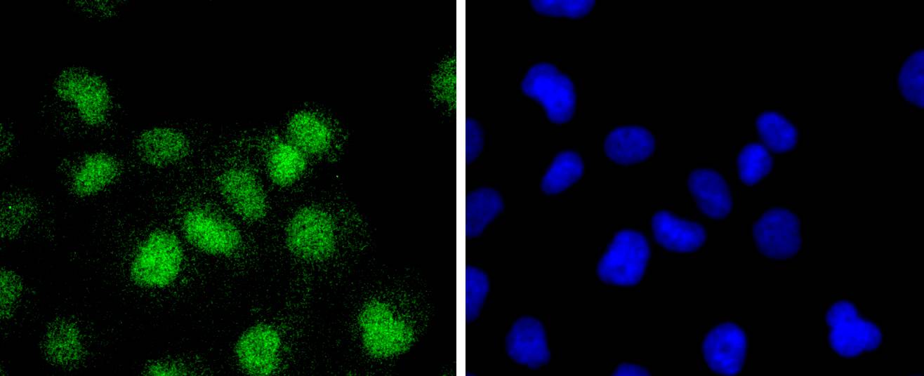 ATF1 Rabbit mAb[49239]