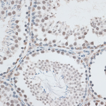 AQR Polyclonal Antibody[30691]