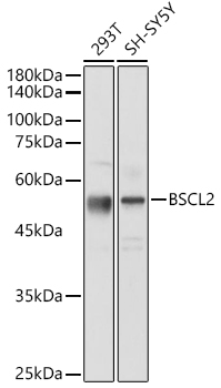 BSCL2 Polyclonal Antibody[2863