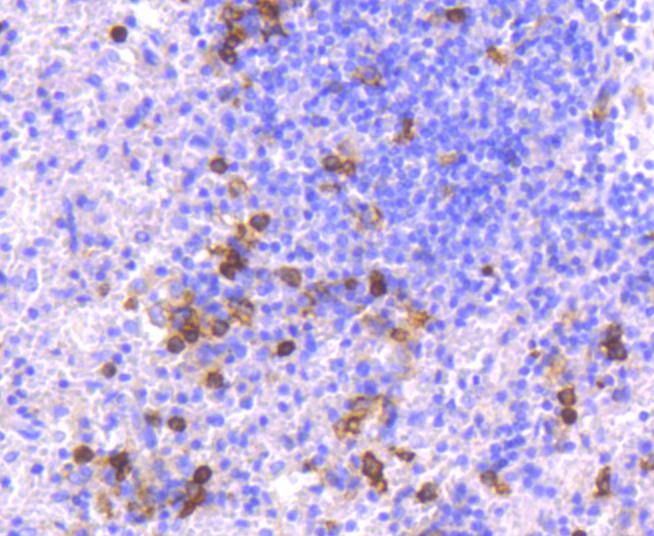 CD14 Rabbit mAb[49003]