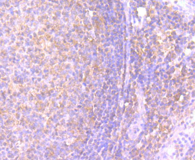 Interferon gamma Rabbit mAb[49