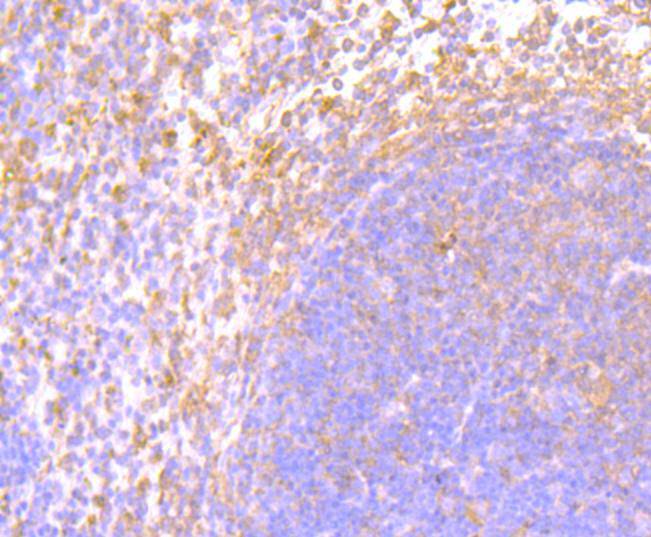 Interferon gamma Rabbit mAb[49