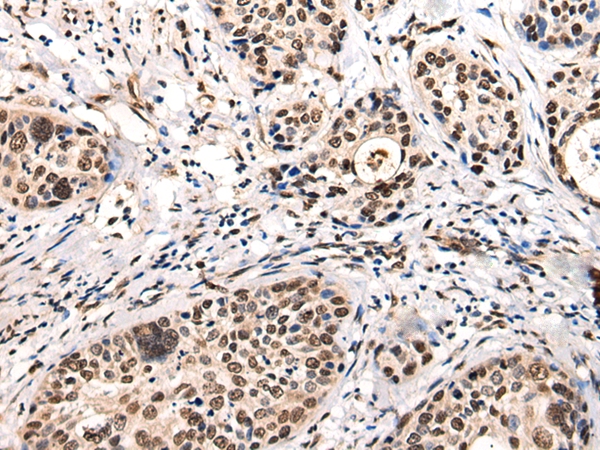 USP6NL Antibody[46700]
