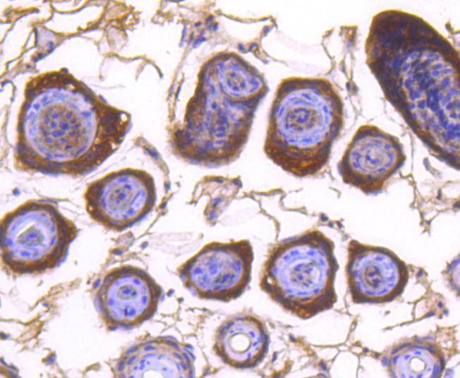 DIABLO Rabbit mAb[48991]