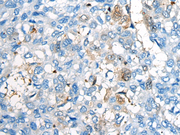 CEP170 Antibody[46474]