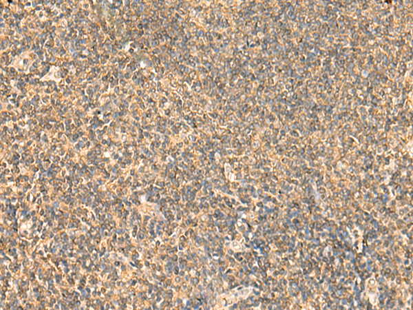 PDAP1 Antibody[47352]