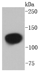 NEDD4-2 Rabbit mAb[49055]