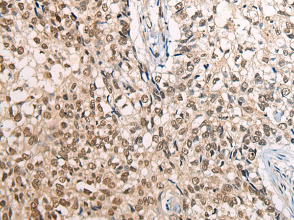 CDT1 Antibody[46460]