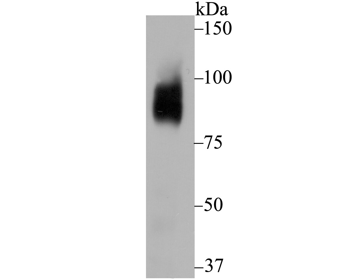 Bcl-6 Rabbit mAb[49860]