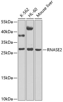 RNASE2 Polyclonal Antibody[317