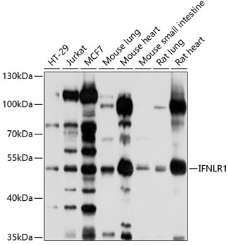 IFNLR1 Polyclonal Antibody[272