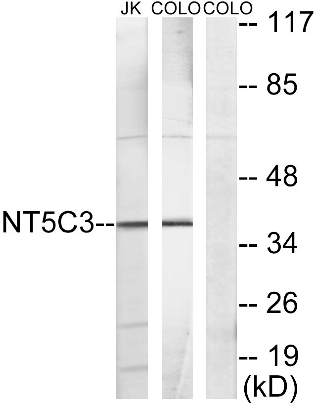 NT5C3 Antibody[47841]