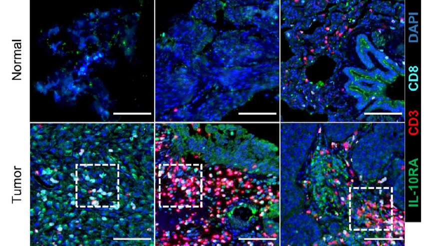【IF 42.5】突破性细菌免疫疗法背后的 “隐形功臣”