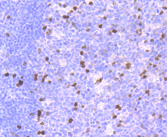 Parvalbumin Rabbit mAb[49428]