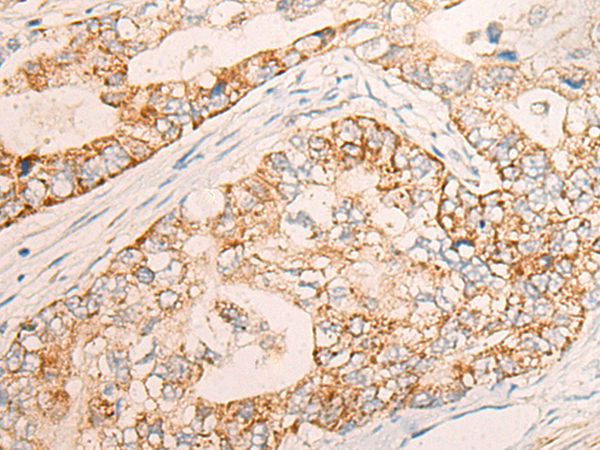 COG2 Antibody[46965]