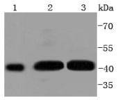 Phospho-MEK1 (S298) Rabbit mAb