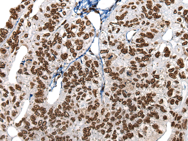 HNRNPR Antibody[46577]