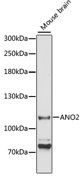 ANO2 Polyclonal Antibody[30478