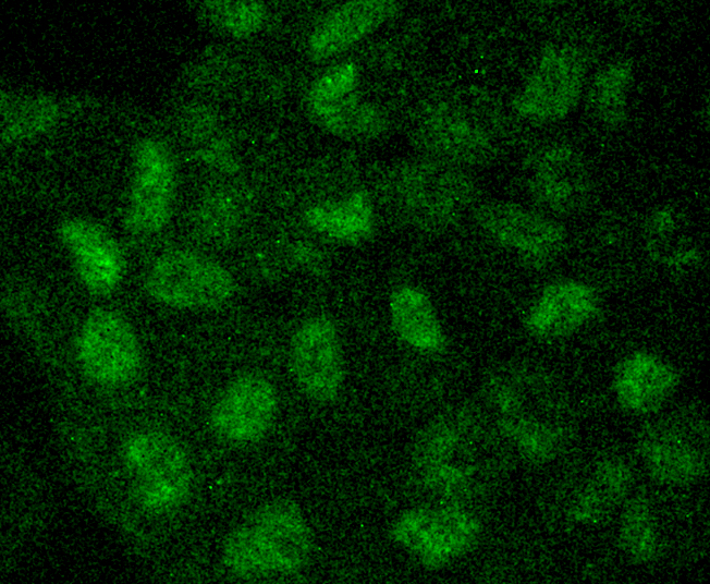MAP1LC3A Rabbit mAb[49049]