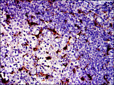 LPlunc1 Antibody[48460]