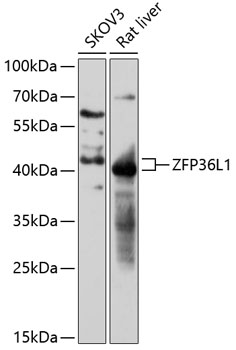 ZFP36L1 Polyclonal Antibody[31
