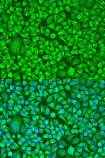 TUBB8 Polyclonal Antibody[3153