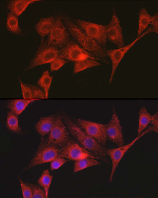 RSPO1 Polyclonal Antibody[3149