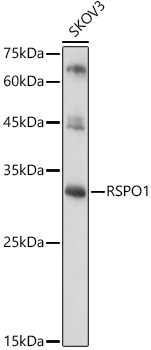 RSPO1 Polyclonal Antibody[3149