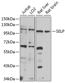 SELP Polyclonal Antibody[28466