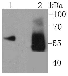 Asparagine synthetase Rabbit m