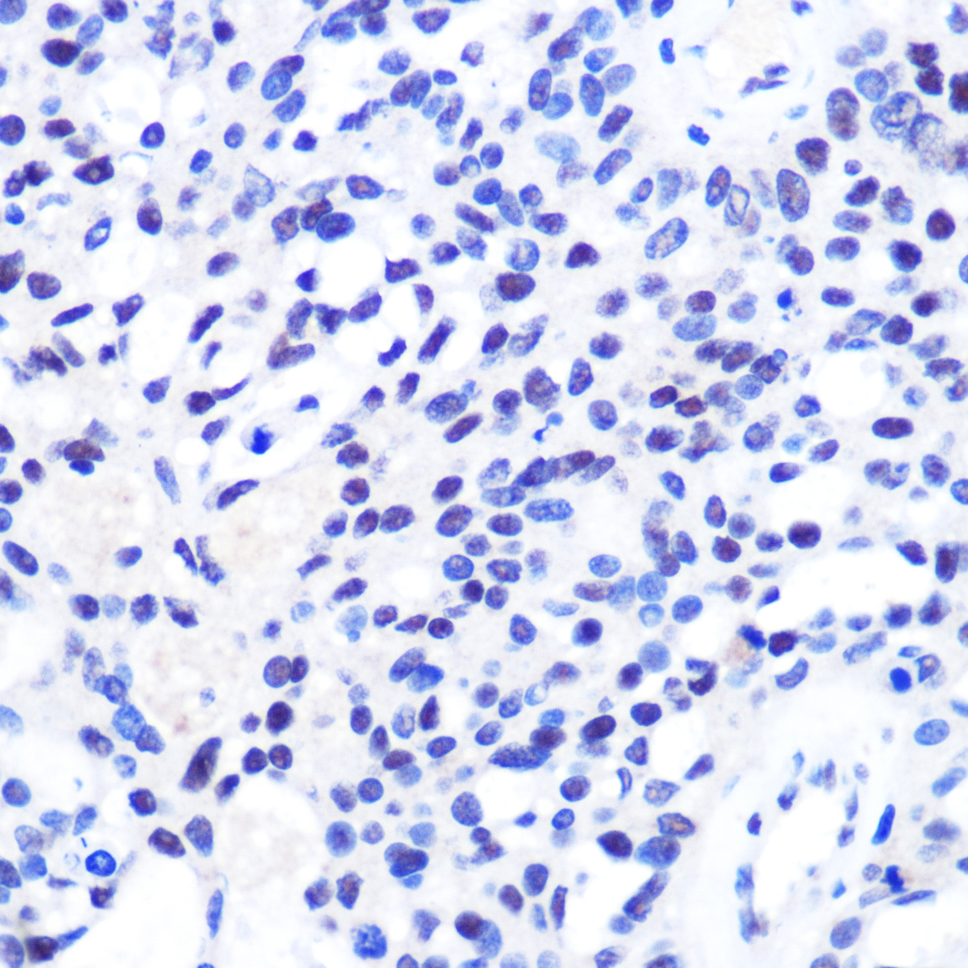 CHD4 Polyclonal Antibody[29086