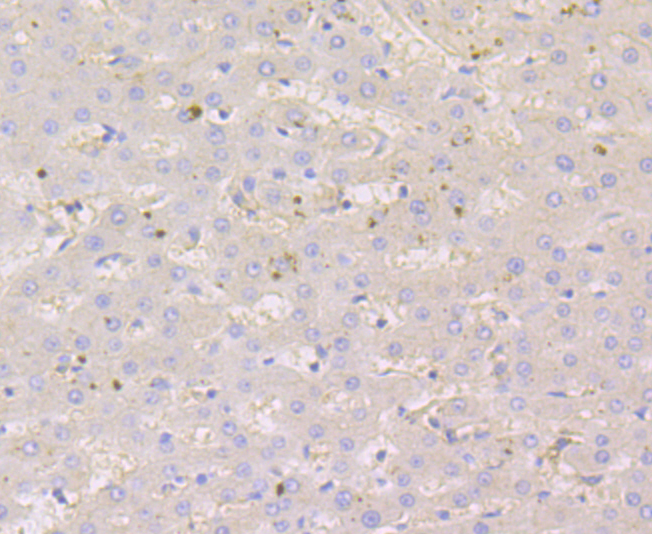 Nectin 2 Rabbit mAb[49959]